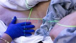 New Prostate Cancer Treatment To Cut Radiotherapy Sessions