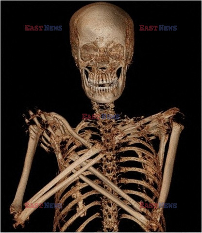 Polscy naukowcy odkryli mumię w ciąży