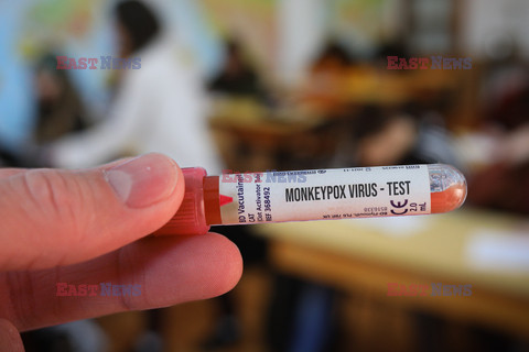 Testy na małpią grypę
