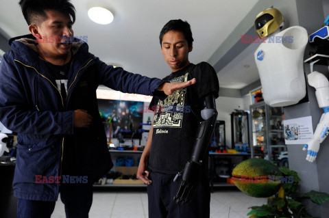Wytwarza bioniczne protezy dla biednych mieszkańców Boliwii