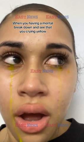Płacze żółtymi łzami