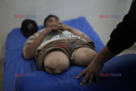 Centrum Protetyczne w Gazie