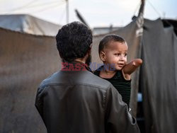 Chłopiec bez rąk i nóg w obozie dla uchodźców