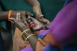 Trędowaci w Indiach - Redux