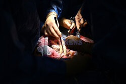 Transplantologia we Francji - AFP