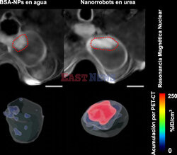 Nanoroboty w leczeniu nowotworów