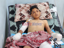 12-latek ranny w ataku Izraela na Khan Yunis