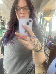 Pies pogryzł jej twarz gdy miała atak padaczki