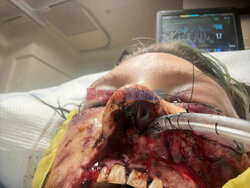 Pies pogryzł jej twarz gdy miała atak padaczki