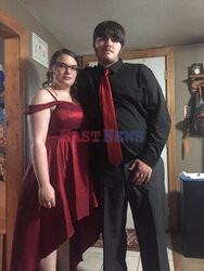 Pies pogryzł jej twarz gdy miała atak padaczki